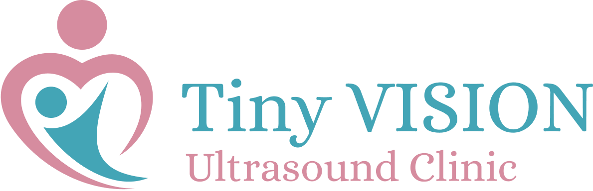 Tiny Vision Logo