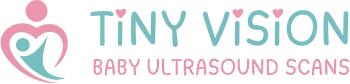 Tiny Vision Logo